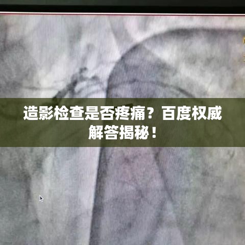 造影检查是否疼痛？百度权威解答揭秘！
