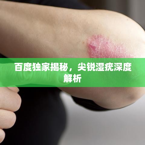 百度独家揭秘，尖锐湿疣深度解析