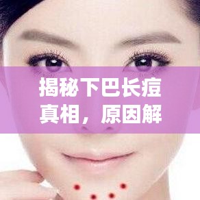 揭秘下巴长痘真相，原因解析与解决方法一网打尽！